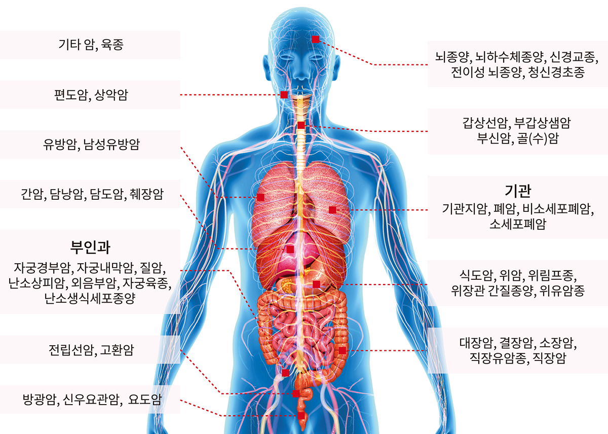 고주파온열치료 적응증